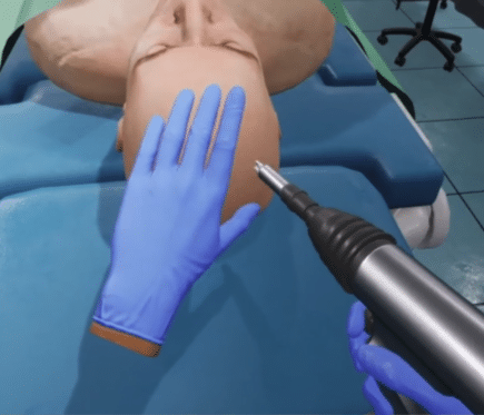 Surgery Using Haptic Gloves